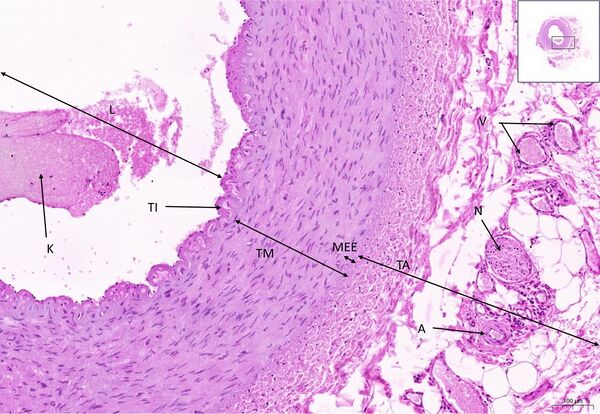 Muscle artery HE 10x.jpg
