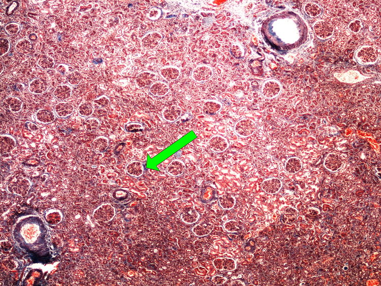 Z1-3 blue trichrome (kidney) modry trichrom (ledvina) 4x oznaceno.jpg
