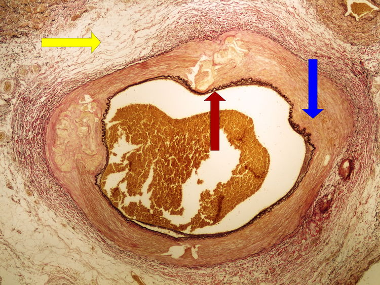 Preparation No. 1 - van Gieson staining (elastic fibers).png