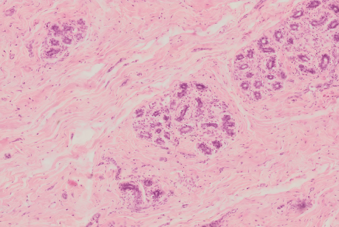 Mammary Gland before Lactation.png