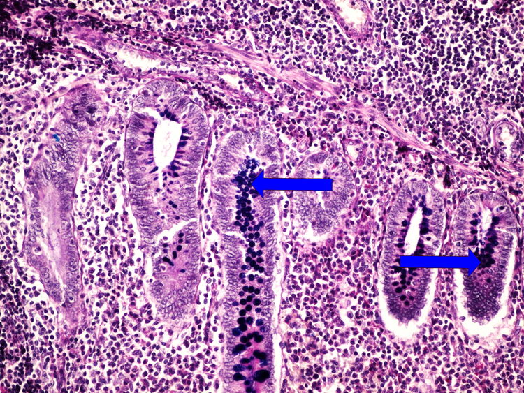 Z1-7 Mowry (appendix) Mowry (apendix) 20x oznaceno.jpg