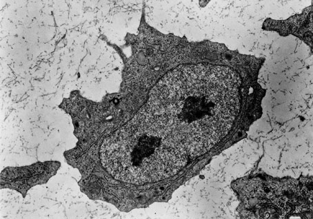 Mesenchymal cell.jpg