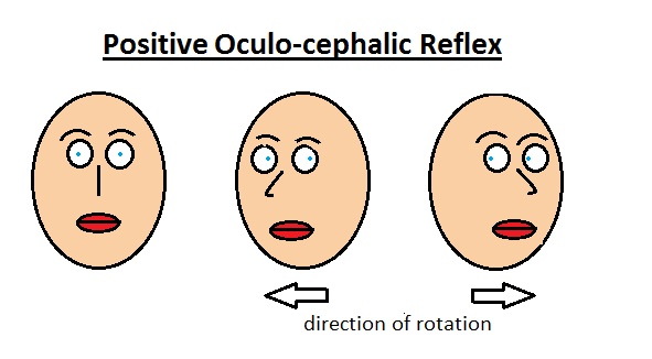 çöplük zar zor Kel dolls eye reflex - firstfamiliesofmaryland.org