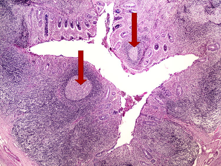 Z1-7 Mowry (appendix) Mowry (apendix) 4x oznaceno.jpg