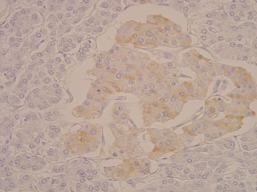 Pancreas - C peptide – upr.jpg