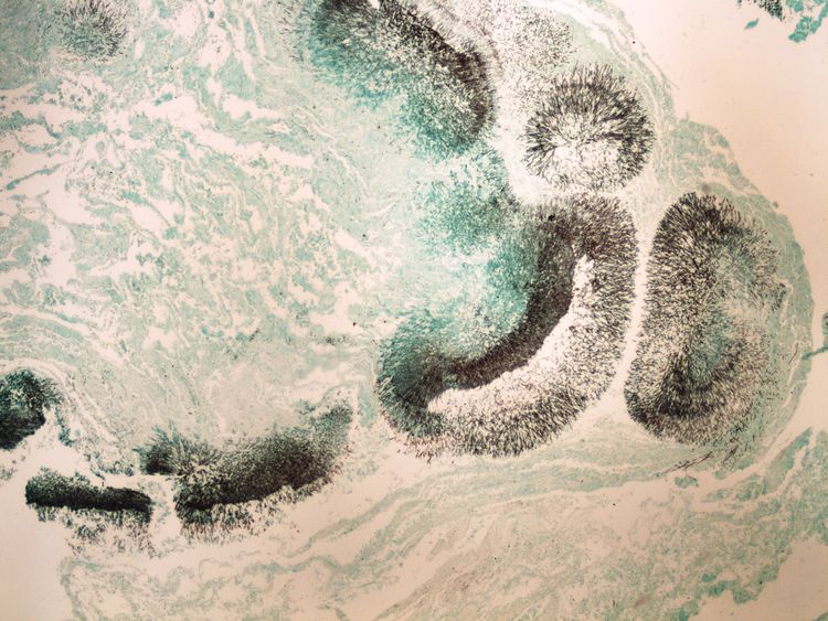 Grocott (mycosis) Grocott (prukaz plisne) 4x.jpg
