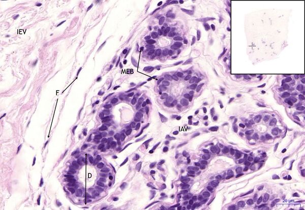 Mamma non lactans, HE 40x.jpeg