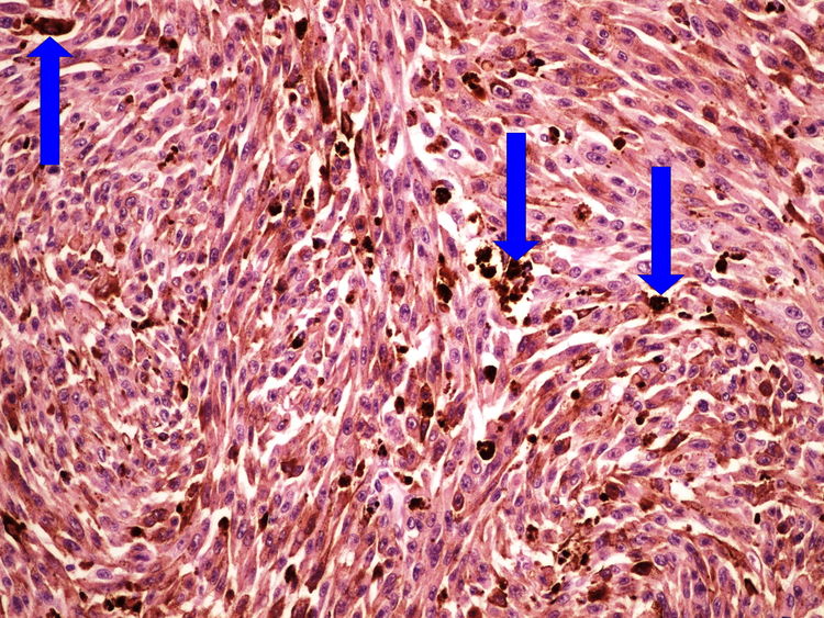 Z4-1 melanin 20x oznaceno.jpg