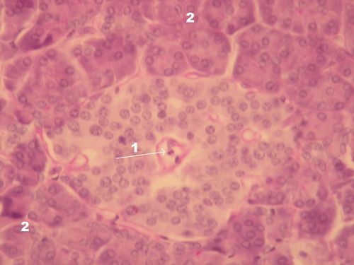 Islet of Langerhans 4 – upr.jpg