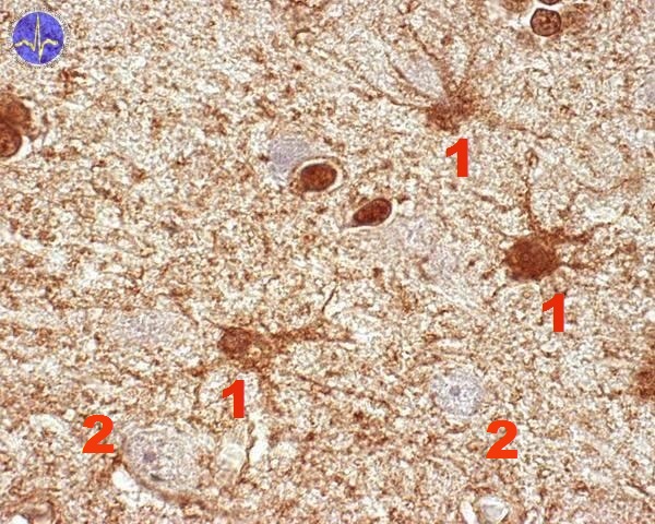 Cerebral cortex (SFLT) - WikiLectures