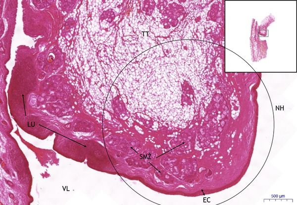 Larynx HE, 2x (2).jpeg