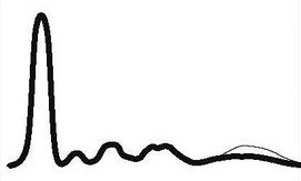 ELFO hypogammaglobulinemia.jpg