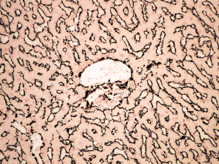Reticulum (liver) retikulum (jatra) 20x.jpg