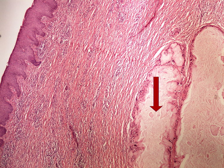 Z4-7 gout dnave tofy 4x oznaceno.jpg