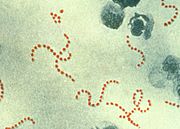 Streptococcus pyogenes k9869.jpg