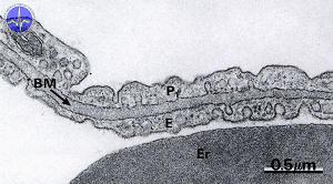 The blood–air barrier.jpg
