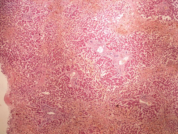 Bilirubin 4x.jpg