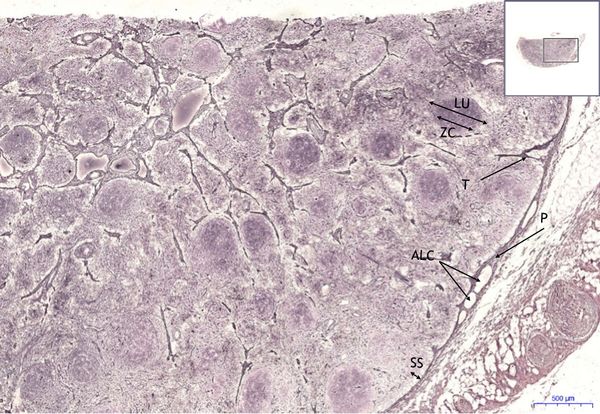 Lymph node AG 2x.jpeg