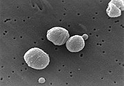 Streptococcus pneumoniae 3455.jpg