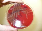 Streptococcus pneumonia R-faze-detail hemolysis 196y65.jpg