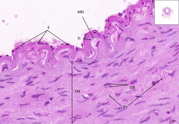 Muscle artery HE 40x.jpg
