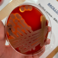 Bacillus cereus, blood agar