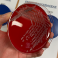 Citrobacter koseri, blood agar