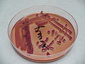 Citrobacter freundii, deoxycholate-citrate agar, detail