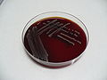 Citrobacter freundii, blood agar, detail