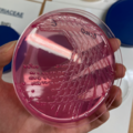 Citrobacter koseri, Endo agar