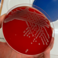 Escherichia coli, blood agar