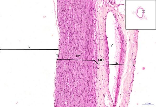 Elastic artery HE5.jpg