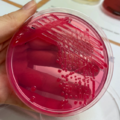 Enterobacter cloacae, Endo agar