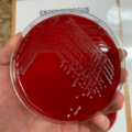 Enterococcus faecalis, blood agar
