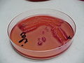 Culturing Escherichia coli on deoxycholate citrate agar'