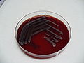 Escherichia coli, blood agar, detail