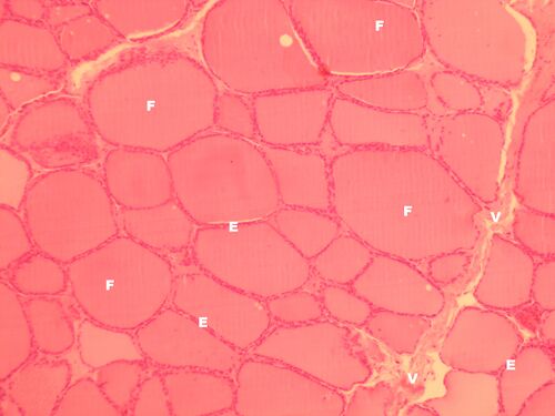 Glandula thyroidea 2.jpeg