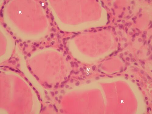 Glandula thyroidea 3.jpeg