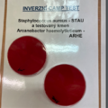 Bacteria used for reverse CAMP test:Staphylococcus aureus + Arcanobacterium haemolyticum, possibly Corynebacterium ulcerans and Corynebacterium pseudotuberculosis