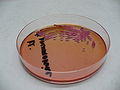 Klebsiella pneumoniae, thiosulfate-citrate-bile salts-sucrose agar (TCBS)