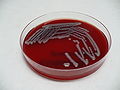Klebsiella pneumoniae, blood agar, detail