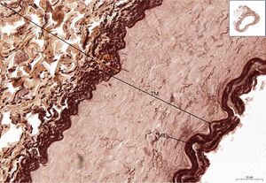 Muscle artery RF 28,9x.jpg
