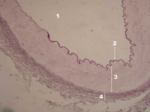 Muscle artery RF 2 upr.jpg