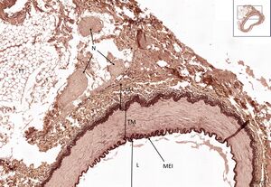 Muscle artery RF 5x.jpg
