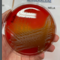 Neisseria lactamica, blood agar