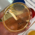 Proteus mirabilis, deoxycholate-citrate agar
