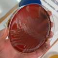 Proteus mirabilis, blood agar