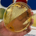 Pseudomonas fluorescens, deoxycholate-citrate agar