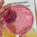 Pseudomonas fluorescens, Endo agar, the smell remotely resembles the scent of jasmine
