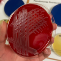 Pseudomonas fluorescens, blood agar, the smell remotely resembles the scent of jasmine